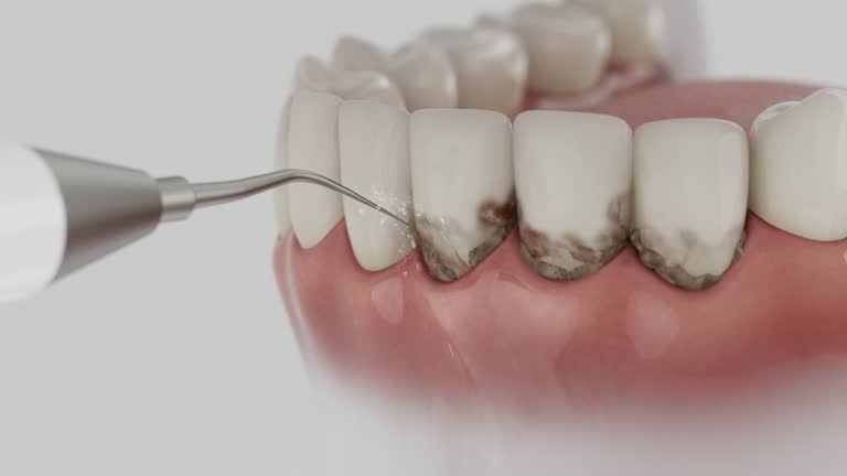 Reliable Dental Implants contractor in Schenectady, NY by Smile Center Dentistry